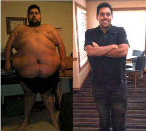 extreme weight loss